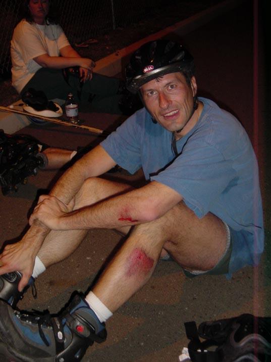 2002-05-07b Rollerhockey blood 2.jpg