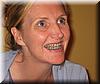 2004-03-17d Dana's Braces.JPG